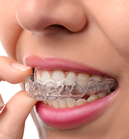 Clear Aligners - Almost Invisible Braces Armonk, NY