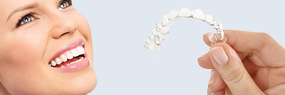 Armonk 7 Things Parents Need to Know About Invisalign Teen