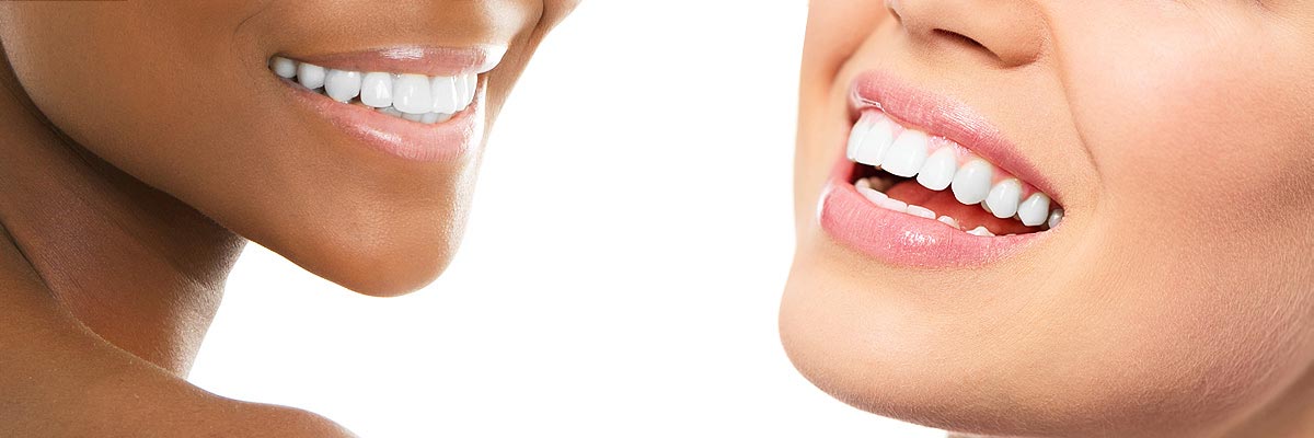 Armonk Teeth Whitening