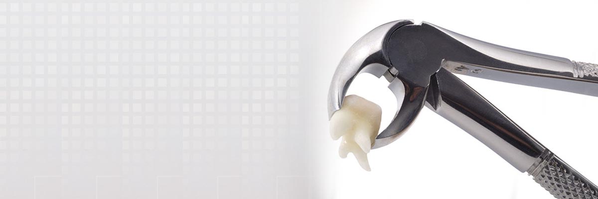 Armonk Tooth Extraction